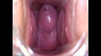 Shift reccomend pics inside vagina