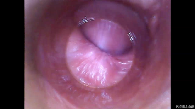 Endoscope vagina