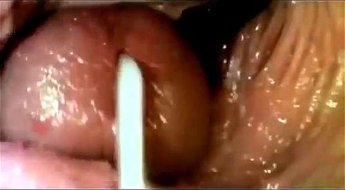 Pics inside vagina