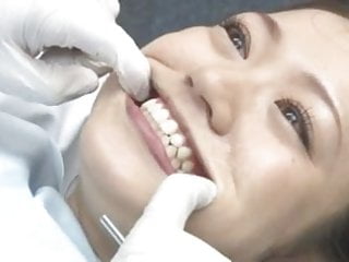 Vicious reccomend teeth fillings